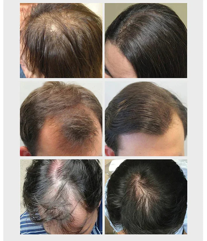 ACEITE  ANTICAIDA  HAIR CARE