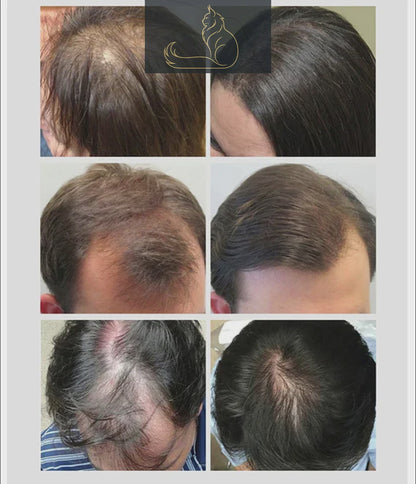 ACEITE  ANTICAIDA  HAIR CARE